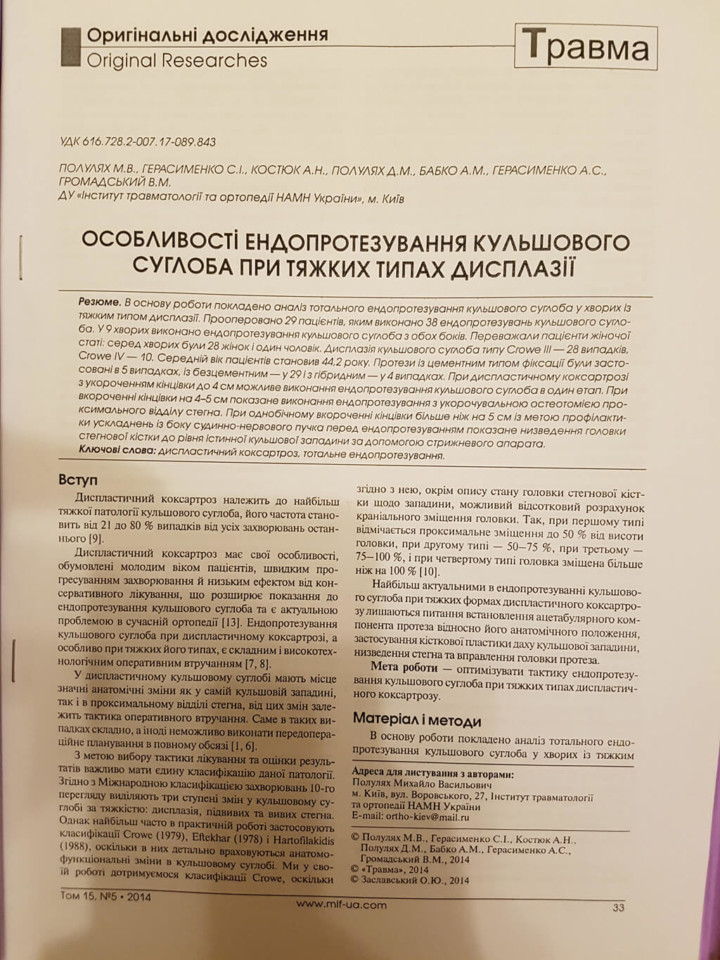 Особенности эндопротезирования тазобедренного сустава при тяжёлых типах дисплазии