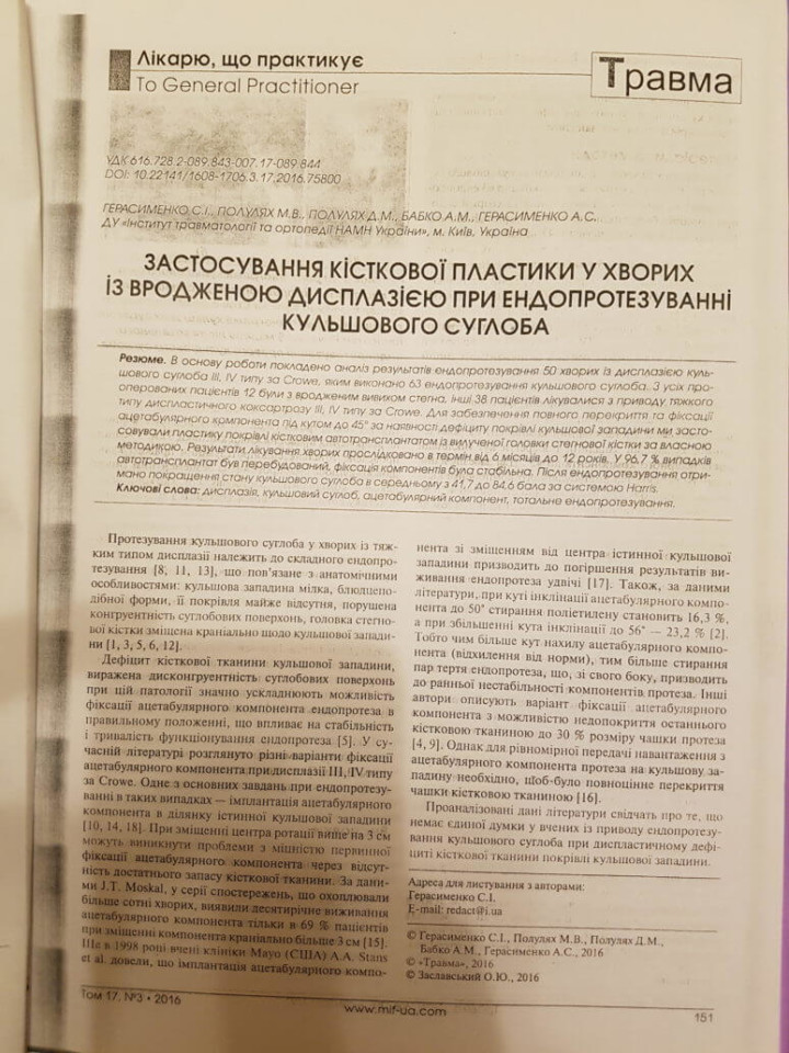 Использование костной пластики при эндопротезировании тазобедренного сустава