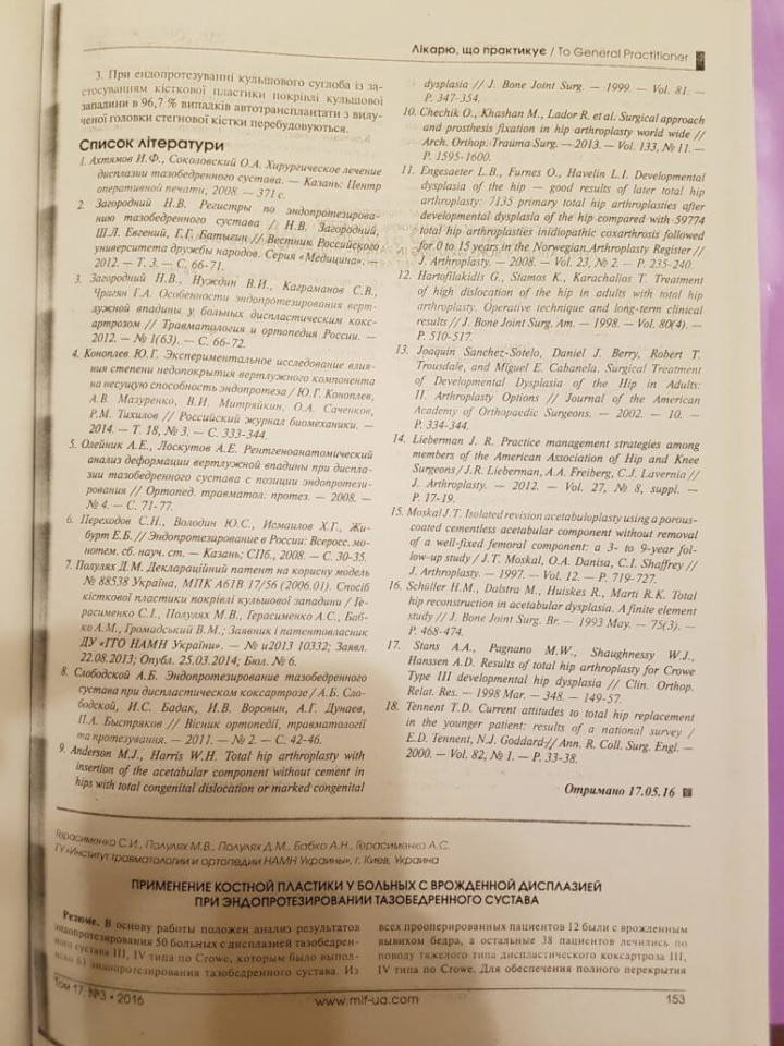 Использование костной пластики при эндопротезировании тазобедренного сустава