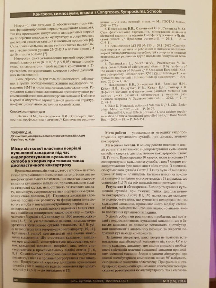 Место костной пластики кровли тазобедренной впадины при эндопротезировании тазобедренного сустава