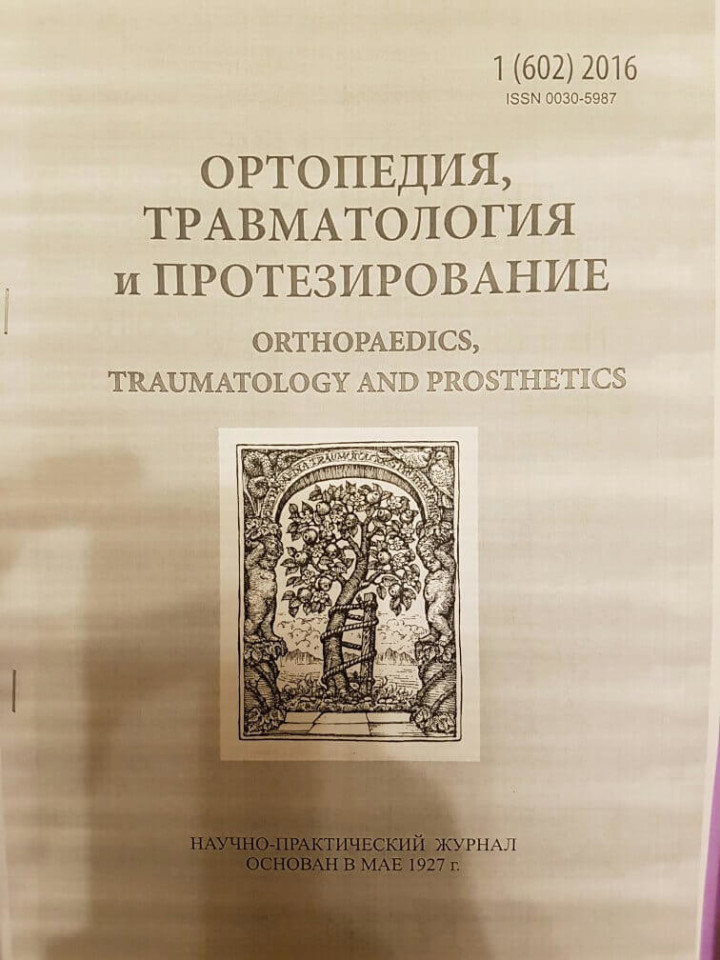 Особенности эндопротезирования тазобедренного сустава