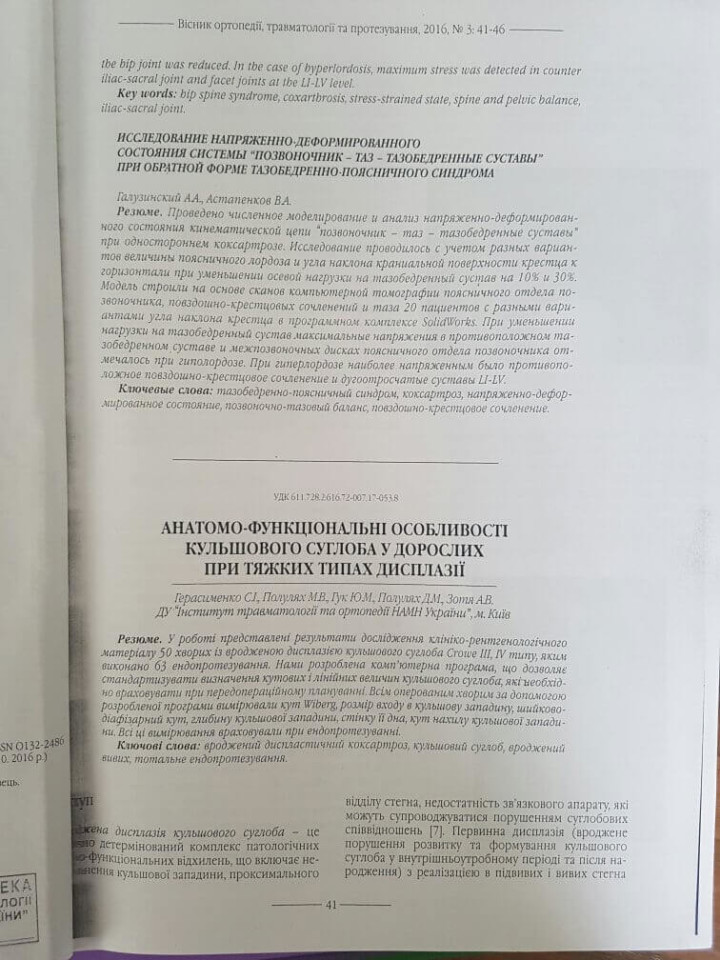 Анатомо-функциональные особенности тазобедренного сустава у взрослых при тяжёлых типах дисплазии