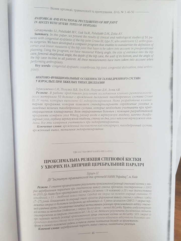 Анатомо-функциональные особенности тазобедренного сустава у взрослых при тяжёлых типах дисплазии