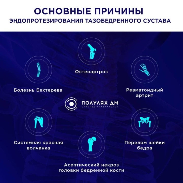 Причины эндопротезирования